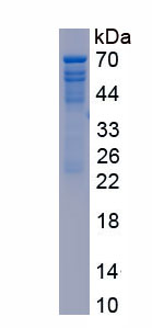 Recombinant Bestrophin 1 (BEST1)