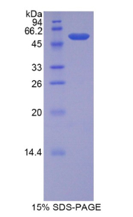 Recombinant Lipase, Bile Salt Dependent (BSDL)