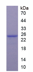 Recombinant Heat Shock 70kDa Protein 5 (HSPA5)