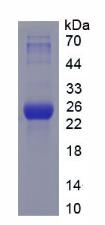 Recombinant Heat Shock 70kDa Protein 5 (HSPA5)