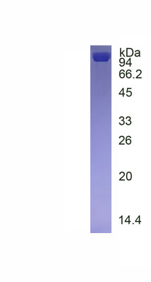 Recombinant Heat Shock 70kDa Protein 5 (HSPA5)