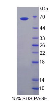 Recombinant Calcineurin Binding Protein 1 (CABIN1)