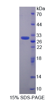 Recombinant Calcyclin Binding Protein (CACYBP)