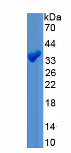 Recombinant Calcium Activated Nucleotidase 1 (CANT1)