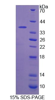 Recombinant Calcium Activated Nucleotidase 1 (CANT1)