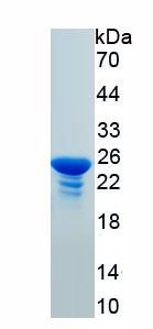 Recombinant Core Binding Factor Beta Subunit (CBFb)