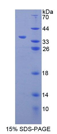 Recombinant Carbonyl Reductase 1 (CBR1)