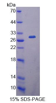 Recombinant Carbonyl Reductase 1 (CBR1)