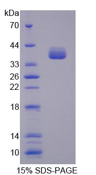 Recombinant Carbonyl Reductase 1 (CBR1)