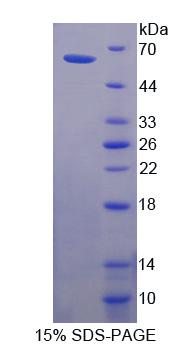 Recombinant Corneodesmosin (CDSN)