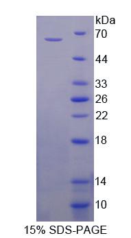 Recombinant Chromodomain Protein, Y-Linked 1 (CDY1)