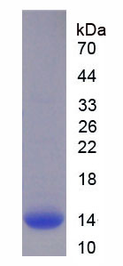 Recombinant Chorionic Gonadotropin Beta Polypeptide 1 (CGb1)