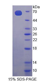 Recombinant Choline Kinase Alpha (CHKa)