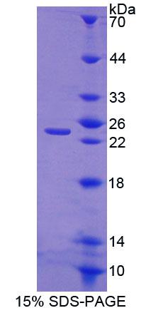 Recombinant Chondrolectin (CHODL)