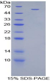 Recombinant Cartilage Intermediate Layer Protein (CILP)