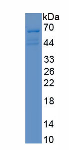 Recombinant Cartilage Intermediate Layer Protein (CILP)