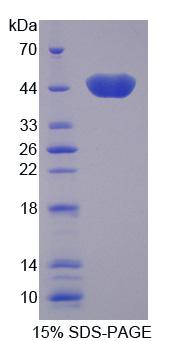 Recombinant Creatine Kinase, Mitochondrial 2, Sarcomeric (CKMT2)