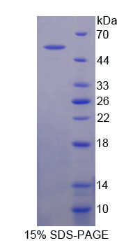 Recombinant Carnitine Acetyltransferase (CRAT)