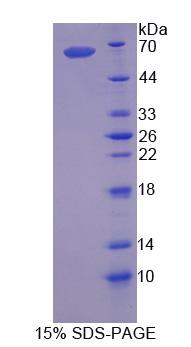 Recombinant Corticotropin Releasing Hormone Binding Protein (CRHBP)