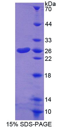 Recombinant Carnitine-O-Octanoyltransferase (CORT)