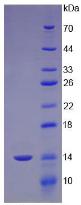 Recombinant Cubilin (CUBN)