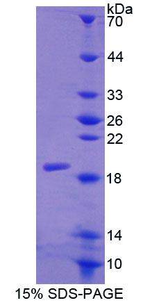 Recombinant Calcitonin Receptor (CTR)