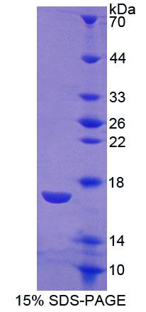 Recombinant Calcitonin Receptor (CTR)