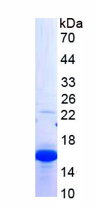 Recombinant Catalase (CAT)