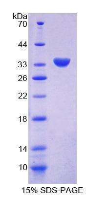 Recombinant CHN2