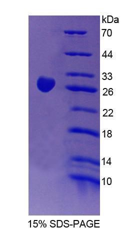 Recombinant Chimerin 2 (CHN2)