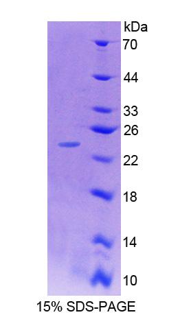 Recombinant Chimerin 2 (CHN2)