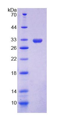Recombinant Constitutive Androstane Receptor (CAR)
