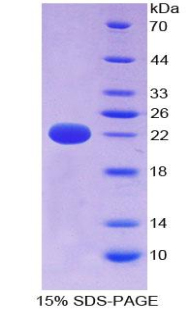 Recombinant Cylindromatosis (CYLD)