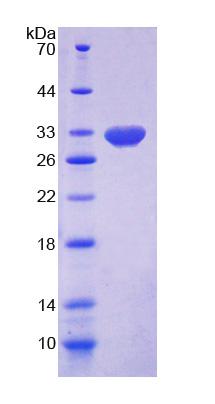 Recombinant Dishevelled Associated Activator Of Morphogenesis 1 (DAAM1)