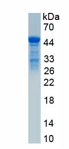 Recombinant Dermatopontin (DPT)