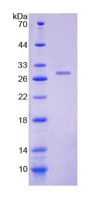 Recombinant Docking Protein 1 (DOK1)