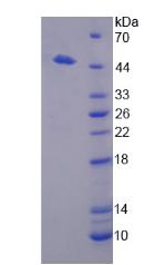 Recombinant Dipeptidase 1, Renal (DPEP1)