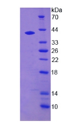 Recombinant Dystrobrevin Binding Protein 1 (DTNBP1)