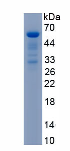 Recombinant Dysferlin (DYSF)