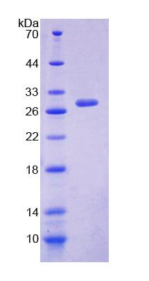 Recombinant Dystonin (DST)