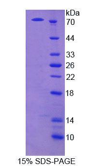 Recombinant Extracellular Matrix Protein 1 (ECM1)