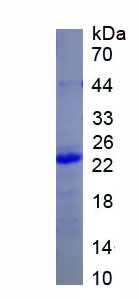 Recombinant Epithelial Cell Transforming Sequence 2 (ECT2)