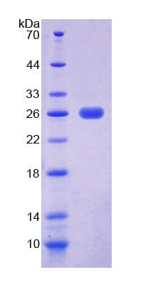 Recombinant Eukaryotic Translation Elongation Factor 2 (EEF2)