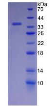 Recombinant Endoplasmic Reticulum To Nucleus Signalling 1 (ERN1)