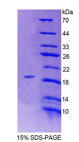 Recombinant Endoplasmic Reticulum Protein 29 (ERP29)