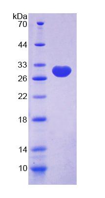 RPC462Hu01.jpg