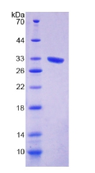 Recombinant Exonuclease 1 (EXO1)