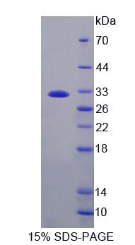 Recombinant Exonuclease 1 (EXO1)