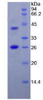 Recombinant Fibroblast Activation Protein Alpha (FAPa)