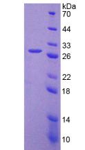 Recombinant Fibroblast Activation Protein Alpha (FAPa)